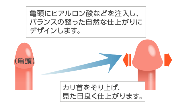 亀頭増大