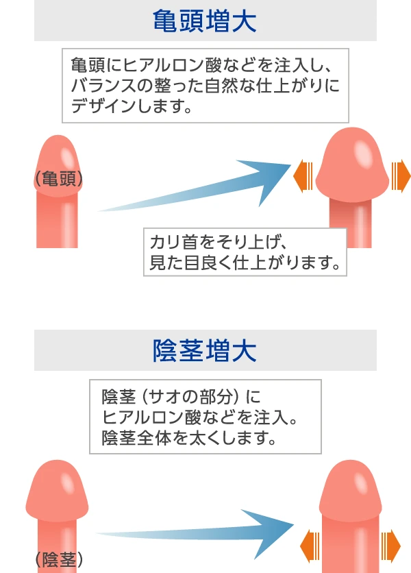 亀頭増大 / 陰茎増大